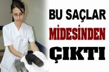 17 yaşındaki kızın midesinden 1 kilogram ağırlığında saç çıktı.