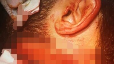  İzmir Katip Çelebi Üniversitesi Atatürk Eğitim Ve Araştırma Hastanesinde