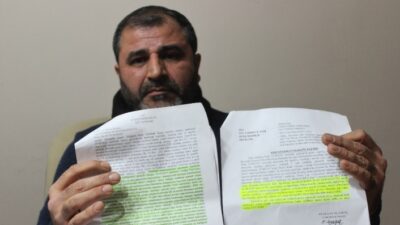 Bursa’da aşırı kilolarından kurtulmak için mide küçültme ameliyatı olan genç