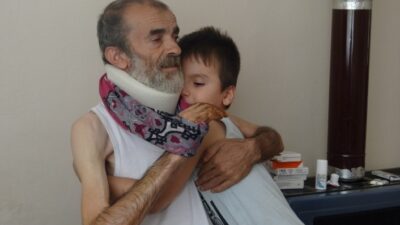  Bursa’da Yaşayan Yusuf Salık Avuç İçinden Oluşan Şişkinliğe Çare