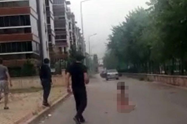  Bursa’da Aralarında Gönül İlişkisi Bulunan Kadını Benzin Dökerek Yakan