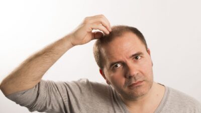 Doğal saç ekim operasyonu hakkında bilgiler veren Saç Sorunları ve